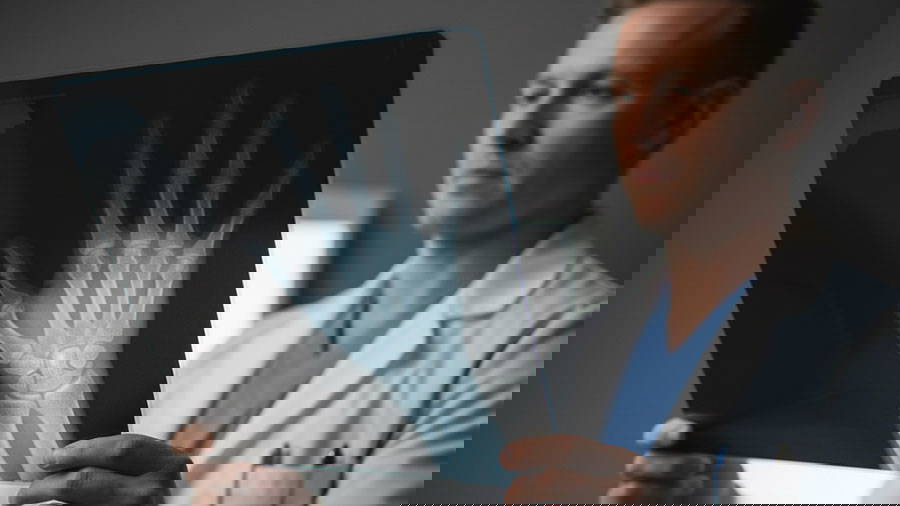 Doctor looking at an x-ray which is often where chondroid lesions are detected